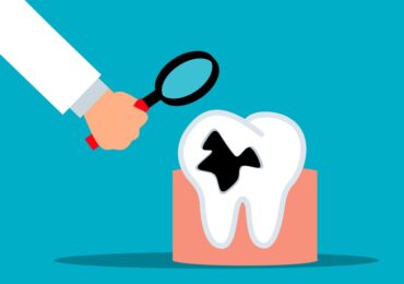 Tooth Decay